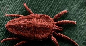 На Кіровоградщині виявили хворих на коросту