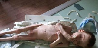На Кіровоградщині чотирирічного хлопчика ледь не заморили голодом у власній сім’ї