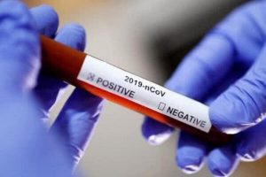 f6739ac-coronavirus-test