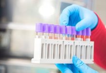 Оперативна інформація щодо поширення коронавірусу COVID-19 на ранок 22 липня