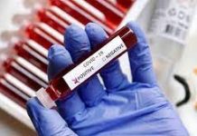Оперативна інформація щодо поширення COVID-19 та пневмонії в Олександрії